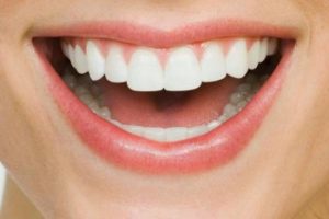 Gum bleeding - How to treat it